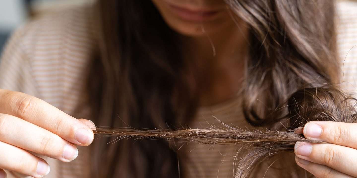 علاج تساقط الشعر: أربع خطوات لمحاربة هذه المشكلة