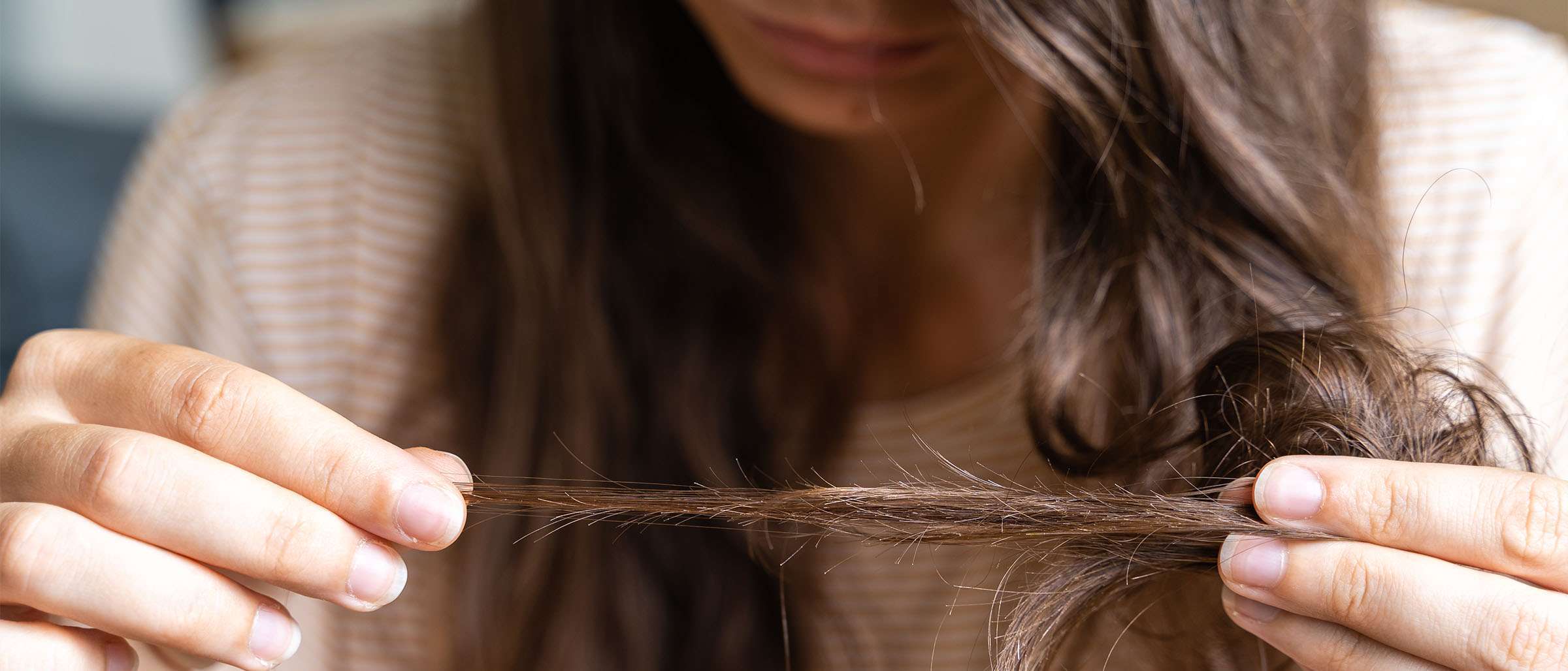 علاج تساقط الشعر: أربع خطوات لمحاربة هذه المشكلة