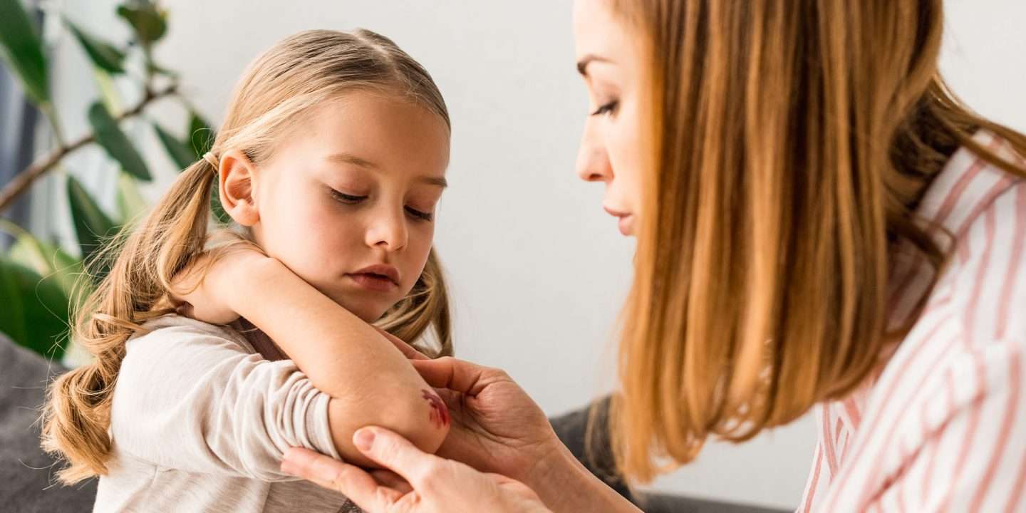 Wounds In Children Are Common During Summer... Here’s How to Treat them
