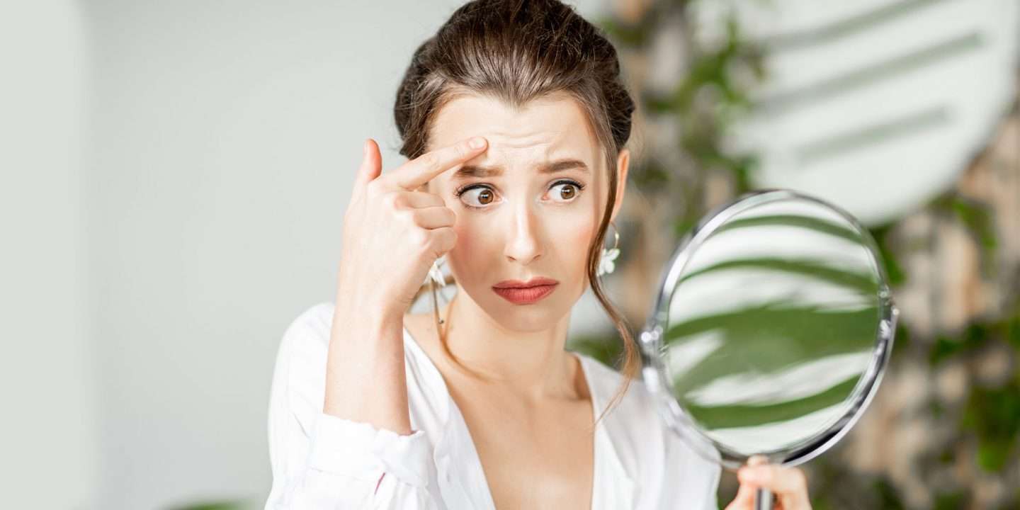 Is Forehead Acne Bothering You?