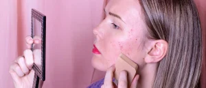 3 Stages You Can Go Through If You Have Acne