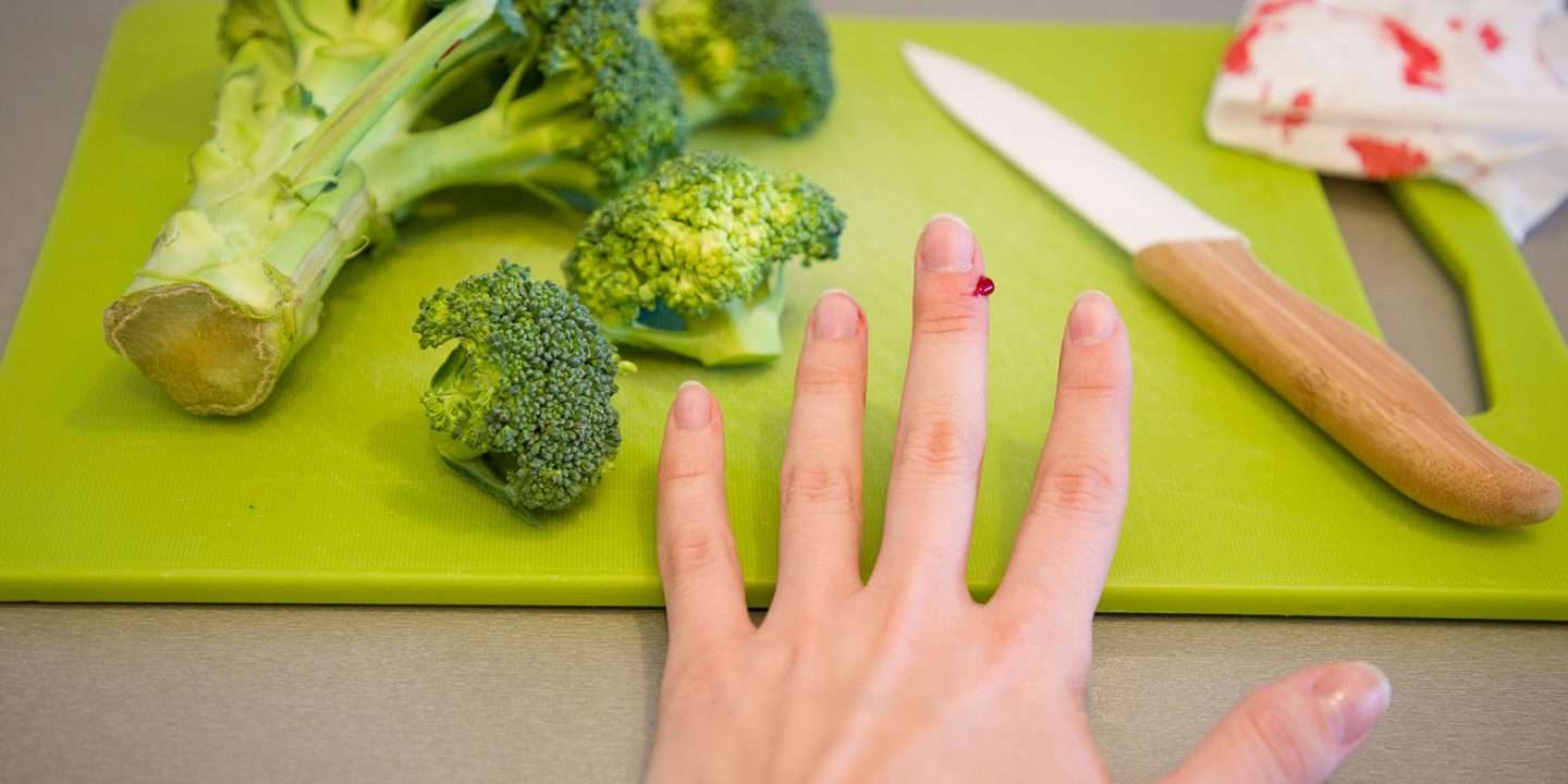 Superficial wound: treatment and healing time