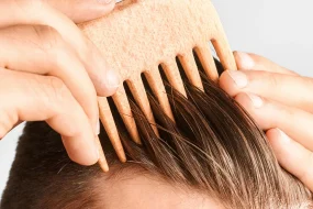 علاج قشرة الشعر: كيف ازيل القشرة من الشعر نهائيا؟