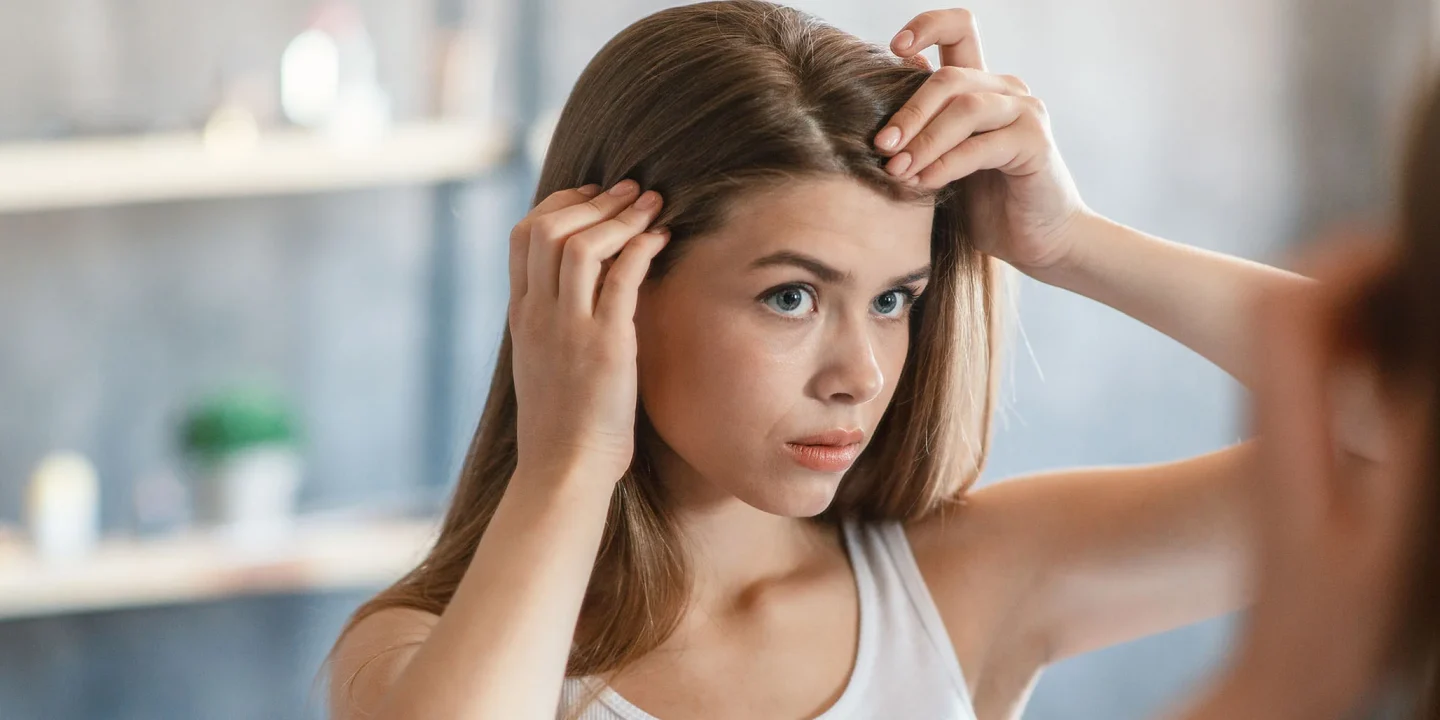 Types of hair dandruff and how to tackle each